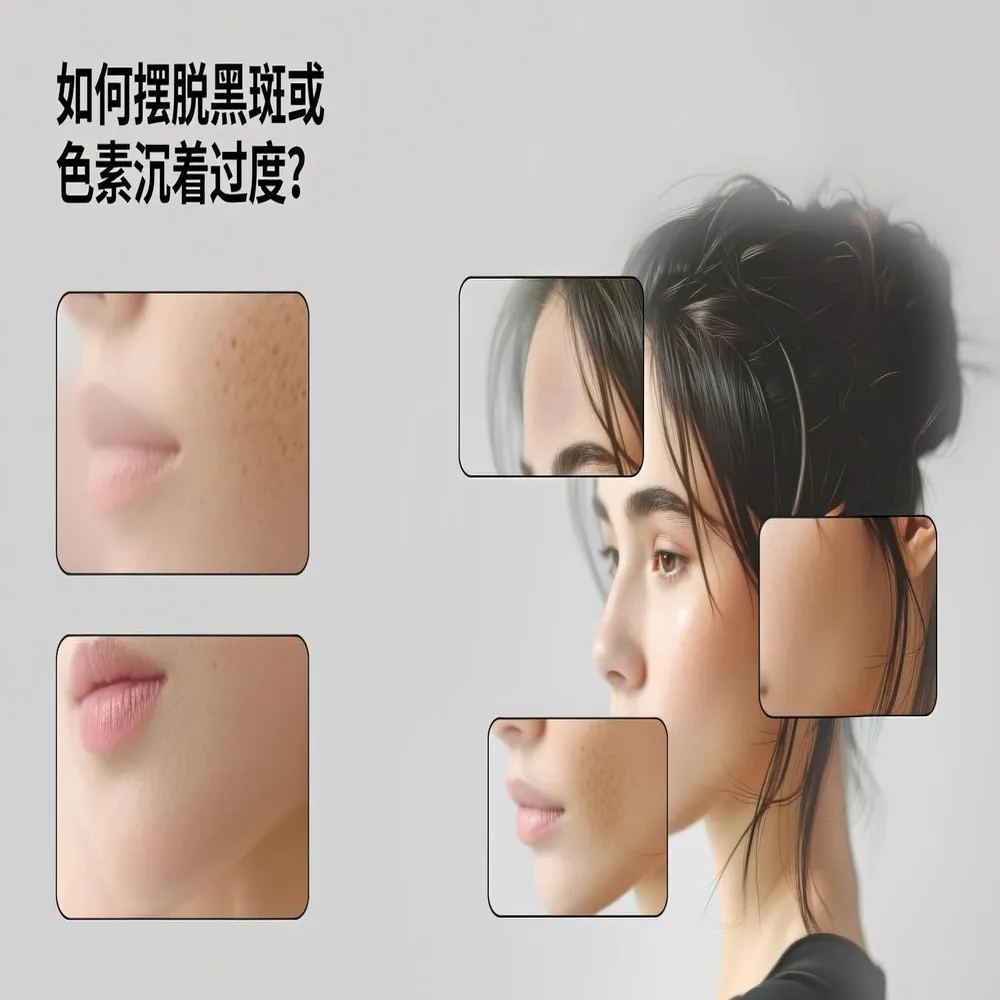 如何摆脱色素沉着
