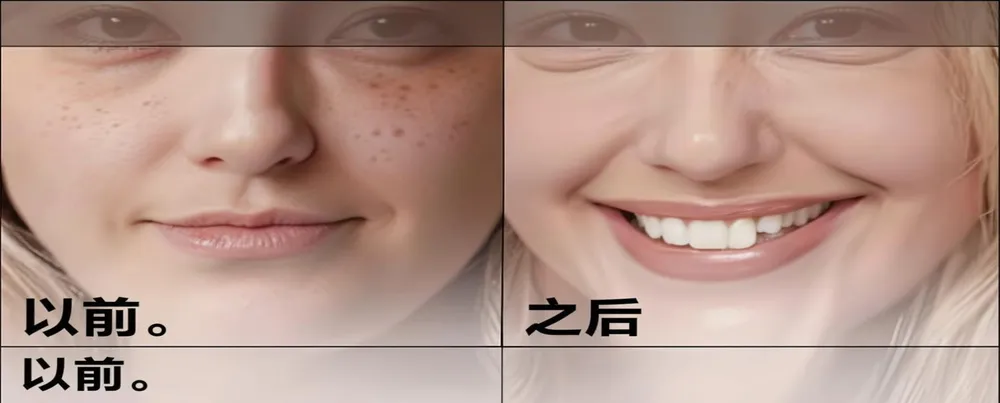 减少疤痕