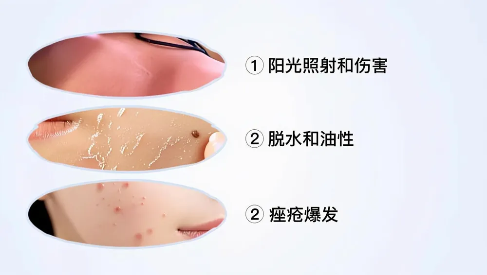 夏季的皮肤状况
