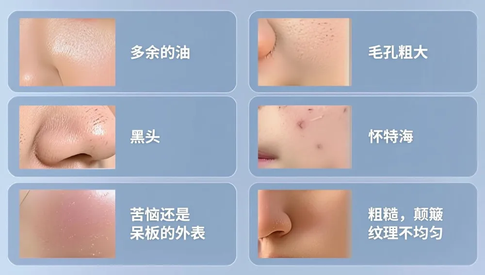 毛孔堵塞对皮肤的影响