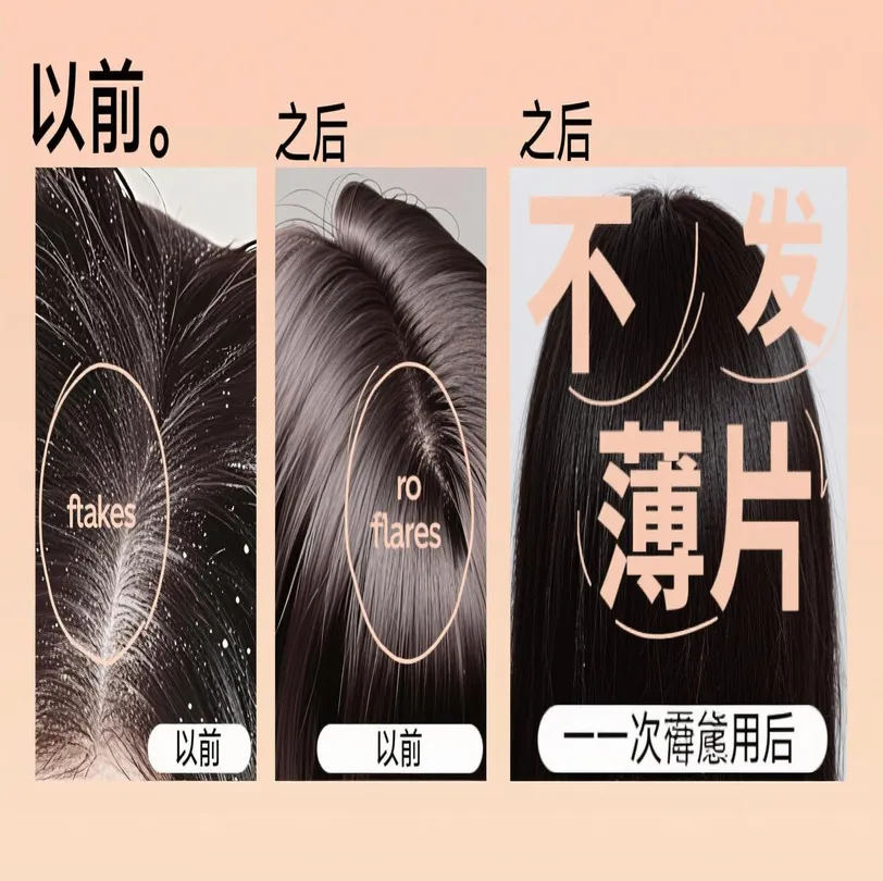 像护理皮肤一样护理头皮