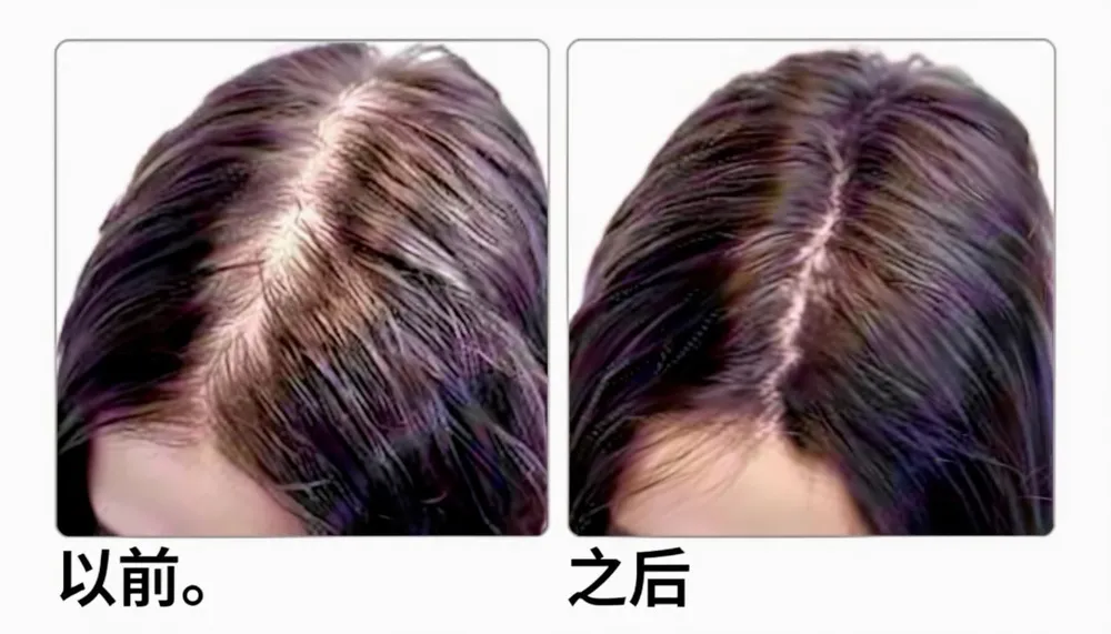 用于头发生长疗法的迷迭香水