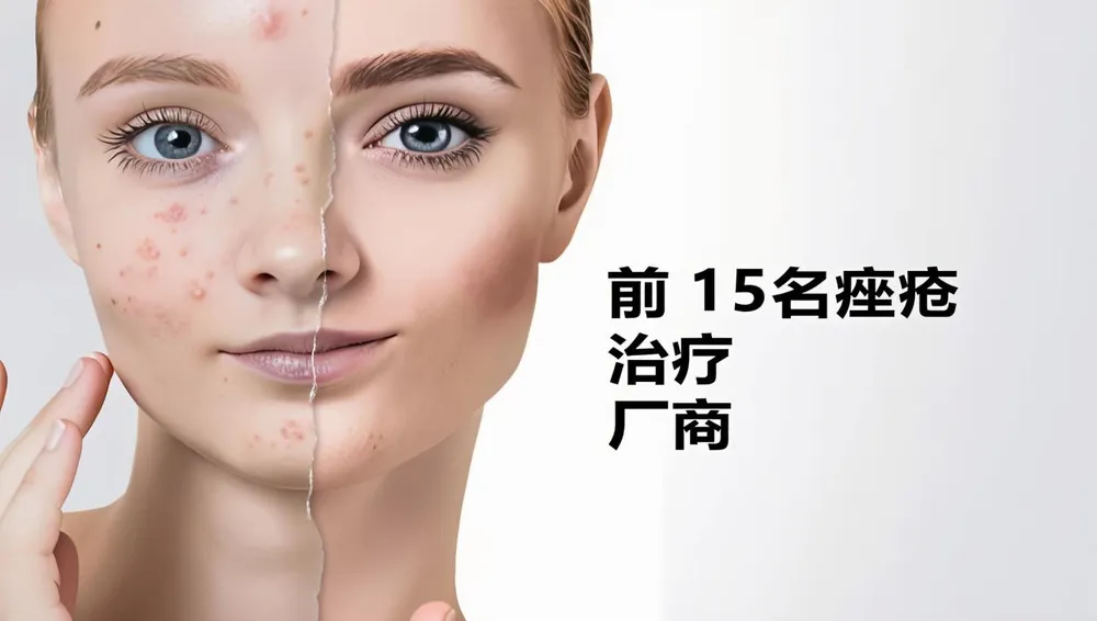顶尖的15大痤疮治疗制造商