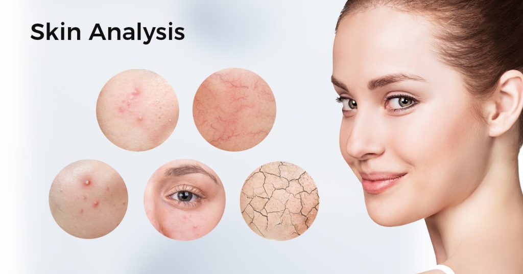 Skin Analysis