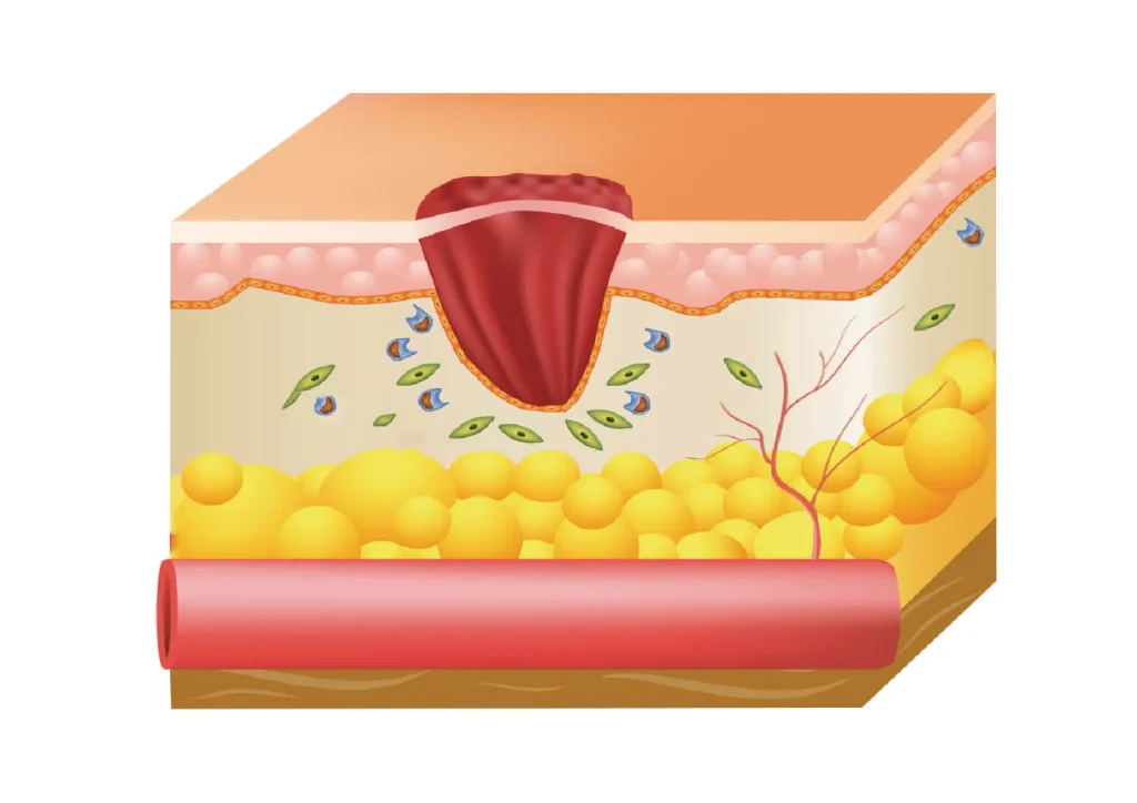 Proliferative stage