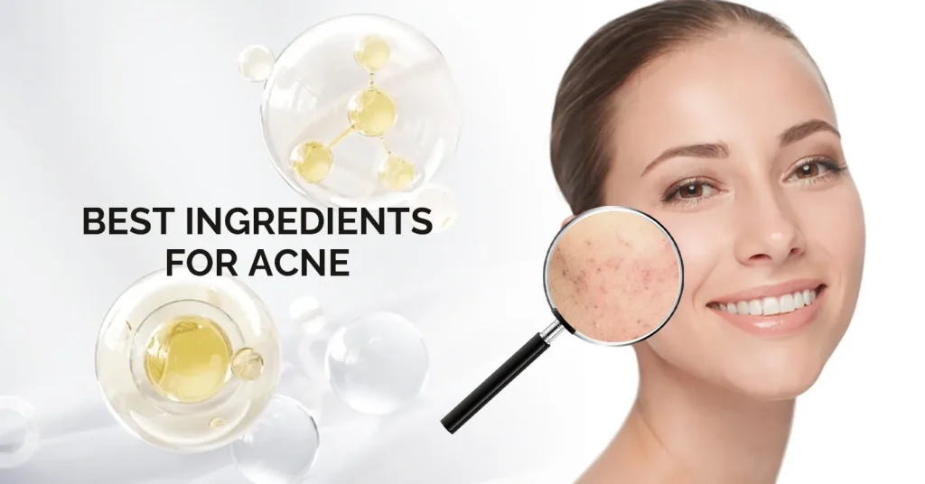 Best Ingredients For Acne